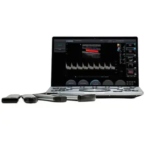 Ветеринарний ультразвуковий апарат CHISON SonoAir 30 (2 датчики) купити